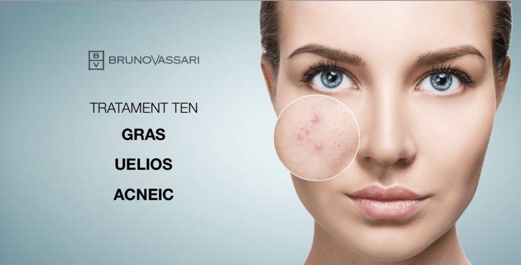 cele mai bune produse pentru acnee și anti-îmbătrânire)