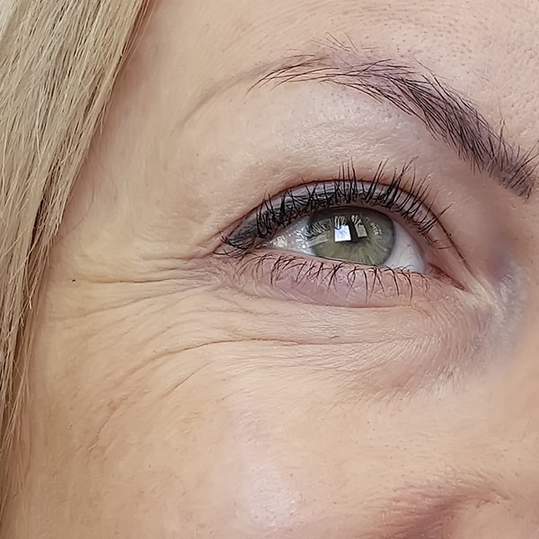 tratament riduri ochi ser anti-imbatranire alyria